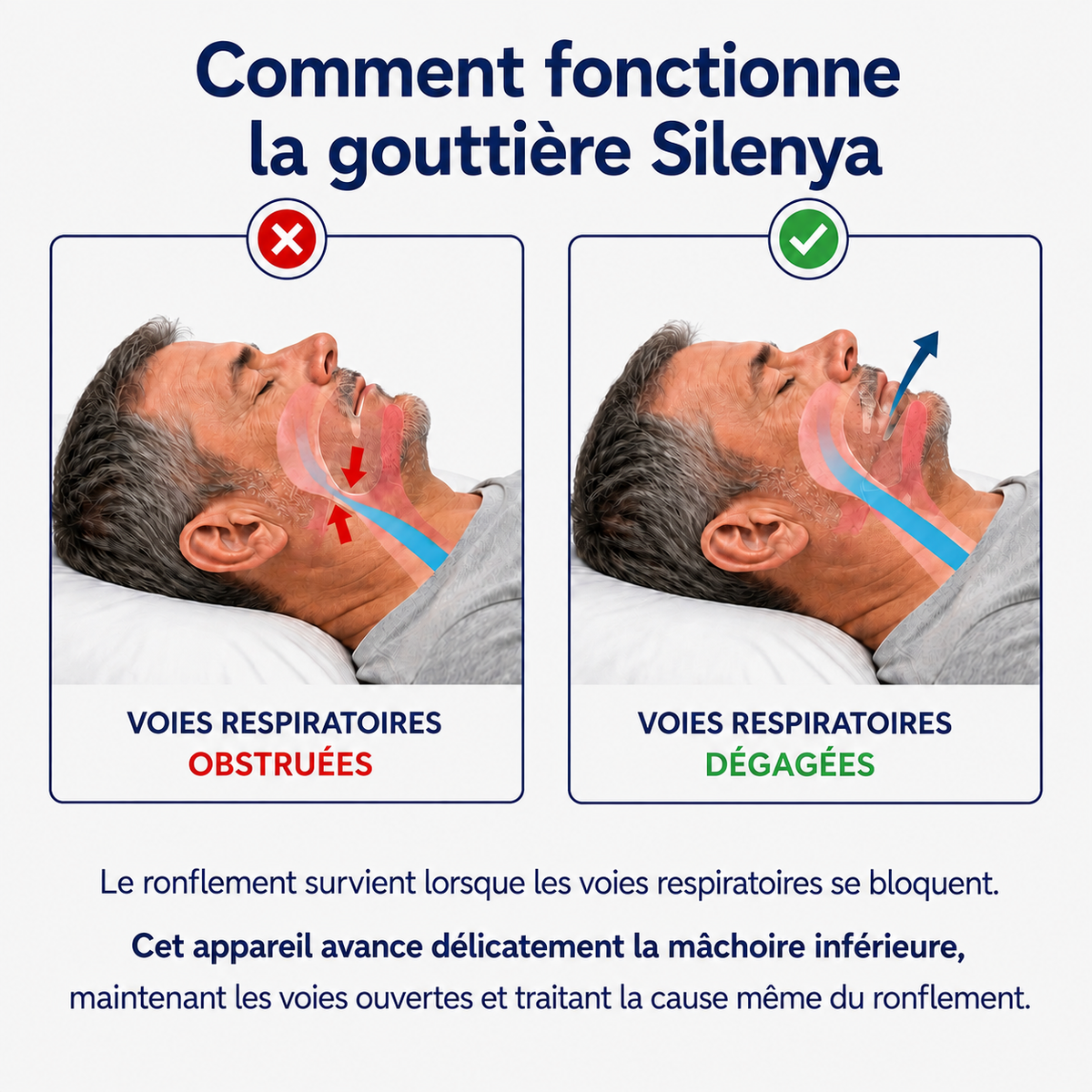 Silenya Confort